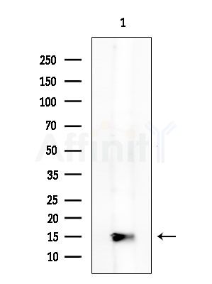 RPS24 Antibody - Western blot analysis of extracts from COLO205 cells, using RPS24 Antibody at 1/1000 dilution.