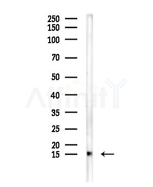 RPS24 Antibody - Western blot analysis of lysates from COLO205 cells, using RPS24 Antibody at 1/1000 dilution.