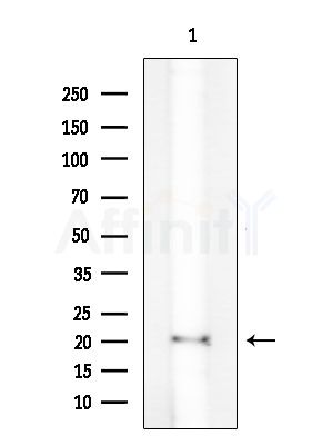 RPL18A Antibody - Western blot analysis of extracts from COLO205 cells, using RPL18A Antibody at 1/1000 dilution.