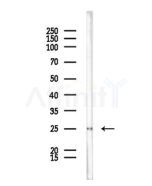 RPL18A Antibody - Western blot analysis of lysates from COLO205 cells, using RPL18A Antibody at 1/1000 dilution.