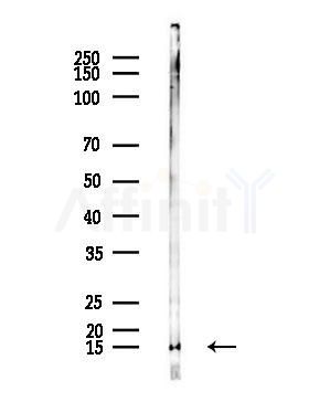 RPL35A Antibody - Western blot analysis of lysates from B16F10-LUC cells(UV,30min treatment), using RPL35A Antibody at 1/1000 dilution.