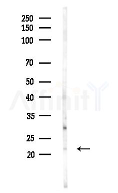 RPL38 Antibody - Western blot analysis of lysates from Hela cells(heat-shock,45min treatment), using RPL38 Antibody at 1/1000 dilution.
