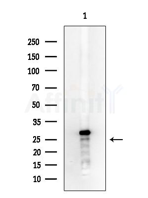 NIP7 Antibody - Western blot analysis of extracts from COLO205 cells, using NIP7 Antibody at 1/1000 dilution.