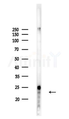 NIP7 Antibody - Western blot analysis of lysates from COLO205 cells, using NIP7 Antibody at 1/1000 dilution.