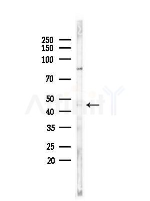 ABHD1 Antibody - Western blot analysis of lysates from COLO205 cells(UV,30min treatment), using ABHD1 Antibody at 1/1000 dilution.