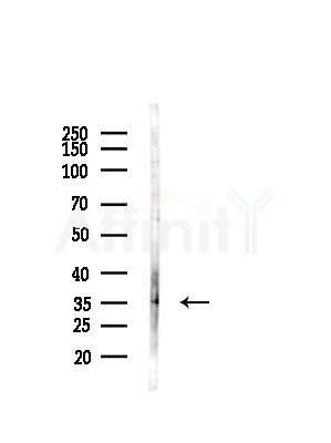 ABHD13 Antibody - Western blot analysis of lysates from Hela cells(starvation,24h treatment), using ABHD13 Antibody at 1/1000 dilution.