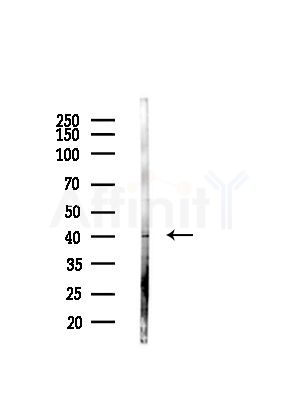 ABHD3 Antibody - Western blot analysis of lysates from Hela cells(starvation,24h treatment), using ABHD3 Antibody at 1/1000 dilution.