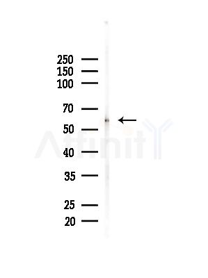 CHRNG Antibody - Western blot analysis of lysates from Mouse brain, using CHRNG Antibody at 1/1000 dilution.