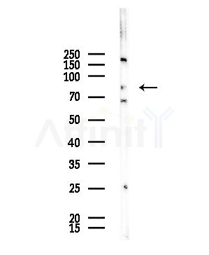 ABLIM1 Antibody - Western blot analysis of lysates from COLO205 cells, using ABLIM1 Antibody at 1/1000 dilution.