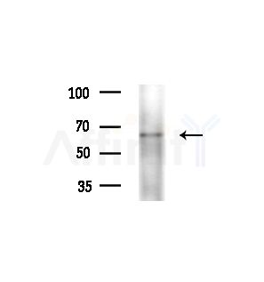 ACAD9 Antibody - Western blot analysis of extracts from A375 cells(heat-shock treatment), using ACAD9 Antibody at 1/1000 dilution.