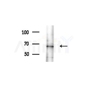 ACAD9 Antibody - Western blot analysis of extracts from Rat brain, using ACAD9 Antibody at 1/1000 dilution.