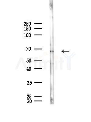 ACAD9 Antibody - Western blot analysis of lysates from Rat brain, using ACAD9 Antibody at 1/1000 dilution.