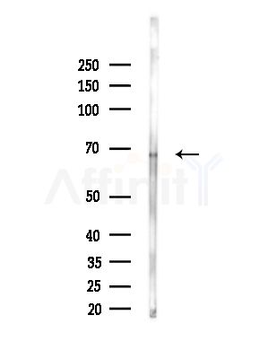 ACAD9 Antibody - Western blot analysis of lysates from A375 cells(heat-shock,45min treatment), using ACAD9 Antibody at 1/1000 dilution.