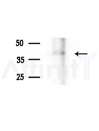 LPGAT1 Antibody - Western blot analysis of extracts from COLO205 cells(heat-shock,45min treatment), using LPGAT1 Antibody at 1/1000 dilution.