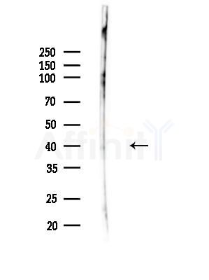 LPGAT1 Antibody - Western blot analysis of lysates from COLO205 cells(heat-shock,45min treatment), using LPGAT1 Antibody at 1/1000 dilution.