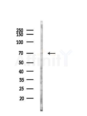 ACOT11 Antibody - Western blot analysis of lysates from COLO205 cells(UV,30min treatment), using ACOT11 Antibody at 1/1000 dilution.