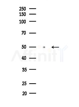 ACOT9 Antibody - Western blot analysis of lysates from MDA-MB-231 cells(heat-shock,45min treatment), using ACOT9 Antibody at 1/1000 dilution.