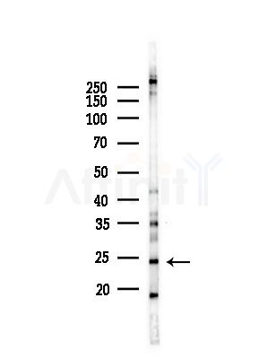 LYPLA2 Antibody - Western blot analysis of lysates from RAW264.