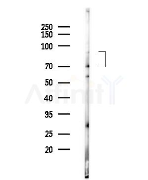 ADAM33 Antibody - Western blot analysis of lysates from PC12 cells(UV,30min treatment), using ADAM33 Antibody at 1/1000 dilution.