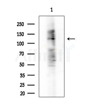 ADAMTS10 Antibody - Western blot analysis of extracts from B16F10-LUC cells(starvation treatment), using ADAMTS10 Antibody at 1/1000 dilution.