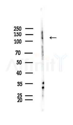 ADAMTS10 Antibody - Western blot analysis of lysates from B16F10-LUC cells(starvation treatment), using ADAMTS10 Antibody at 1/1000 dilution.