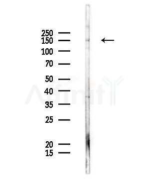 ADAMTS13 Antibody - Western blot analysis of lysates from Rat liver, using ADAMTS13 Antibody at 1/1000 dilution.