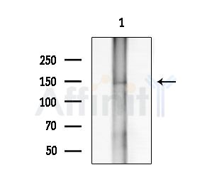 ADAMTS14 Antibody - Western blot analysis of extracts from Rat brain, using ADAMTS14 Antibody at 1/1000 dilution.