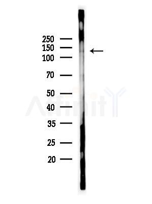 ADAMTS14 Antibody - Western blot analysis of lysates from Rat brain, using ADAMTS14 Antibody at 1/1000 dilution.