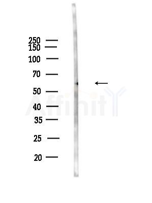 AGXT2 Antibody - Western blot analysis of lysates from Mouse liver, using AGXT2 Antibody at 1/1000 dilution.