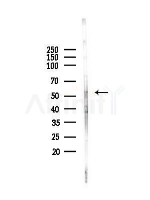 ALDH1A3 Antibody - Western blot analysis of lysates from Hela cells(heat-shock,45min treatment), using ALDH1A3 Antibody at 1/1000 dilution.