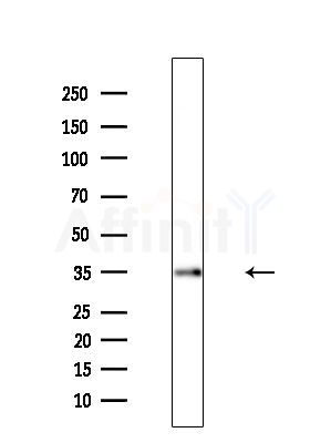AKR1C1 Antibody - Western blot analysis of extracts from Mouse liver, using AKR1C1 Antibody at 1/1000 dilution.