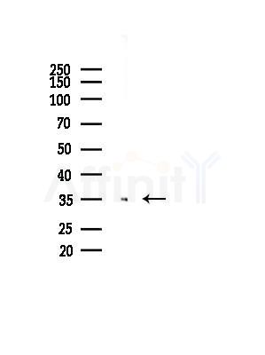 AKR1C1 Antibody - Western blot analysis of lysates from Mouse liver, using AKR1C1 Antibody at 1/1000 dilution.