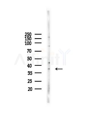 AKR1C4 Antibody - Western blot analysis of lysates from A375 cells(starvation,24h treatment), using AKR1C4 Antibody at 1/1000 dilution.