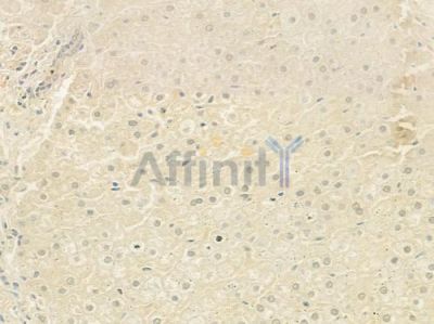 AKR1C4 Antibody - DF9190 at 1/100 staining human normal liver tissue by IHC-P.