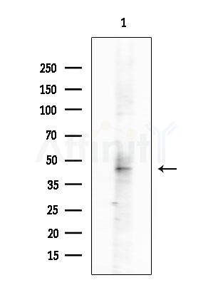GALM Antibody - Western blot analysis of extracts from Rat brain, using GALM Antibody at 1/1000 dilution.