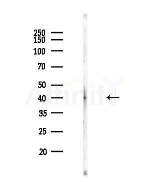 GALM Antibody - Western blot analysis of lysates from Rat brain, using GALM Antibody at 1/1000 dilution.