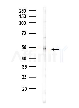 SERPINA2 Antibody - Western blot analysis of lysates from MDA-MB-231 cells(heat-shock,45min treatment), using SERPINA2 Antibody at 1/1000 dilution.