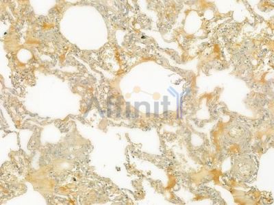 SERPINF2 Antibody - DF9194 at 1/100 staining human normal lung tissue by IHC-P.