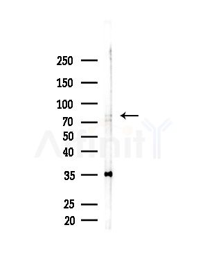 CTNNAL1 Antibody - Western blot analysis of lysates from Mouse brain, using CTNNAL1 Antibody at 1/1000 dilution.