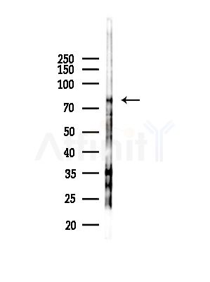 CTNNAL1 Antibody - Western blot analysis of lysates from Rat testis, using CTNNAL1 Antibody at 1/1000 dilution.