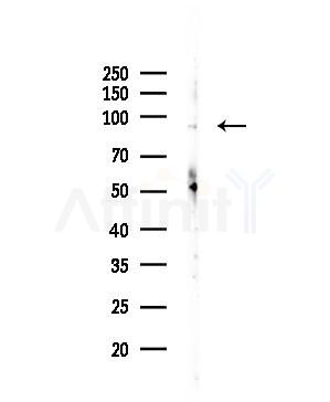 AMPD3 Antibody - Western blot analysis of lysates from PC12 cells(LPS 4h treatment), using AMPD3 Antibody at 1/1000 dilution.