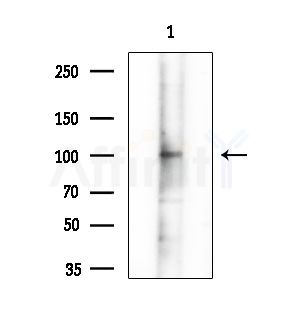 APBA1 Antibody - Western blot analysis of extracts from B16F10-LUC cells(starvation treatment), using APBA1 Antibody at 1/1000 dilution.