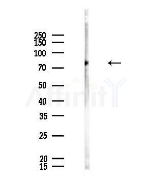 APBA2 Antibody - Western blot analysis of lysates from HUVEC cells, using APBA2 Antibody at 1/1000 dilution.