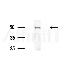 ALS2CR12 Antibody - Western blot analysis of extracts from various samples, using ALS2CR12 Antibody at 1/1000 dilution.