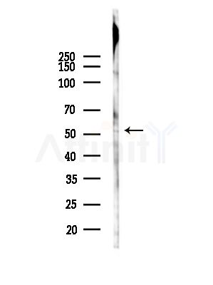 ALS2CR12 Antibody - Western blot analysis of lysates from HepG2 cells(starvation,24h treatment), using ALS2CR12 Antibody at 1/1000 dilution.