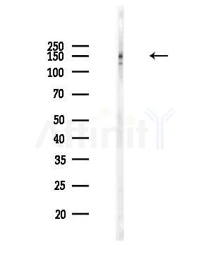 PDS5B Antibody - Western blot analysis of lysates from Rat brain, using PDS5B Antibody at 1/1000 dilution.