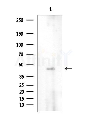 ANGPTL5 Antibody - Western blot analysis of extracts from EC304 cells, using ANGPTL5 Antibody at 1/1000 dilution.