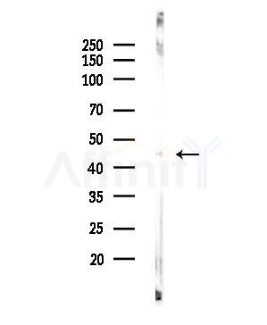 ANGPTL5 Antibody - Western blot analysis of lysates from EC304 cells, using ANGPTL5 Antibody at 1/1000 dilution.