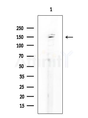 SLC4A3 Antibody - Western blot analysis of extracts from COLO205 cells, using SLC4A3 Antibody at 1/1000 dilution.