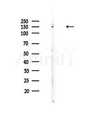 SLC4A3 Antibody - Western blot analysis of lysates from COLO205 cells, using SLC4A3 Antibody at 1/1000 dilution.